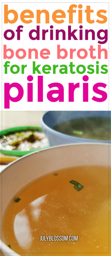 Do you know that you can drink bone broth for keratosis pilaris? Bone broth contains many nurturing ingredients that can soothe, improve and treat keratosis pilaris, along with other natural remedies. Read on for more information!