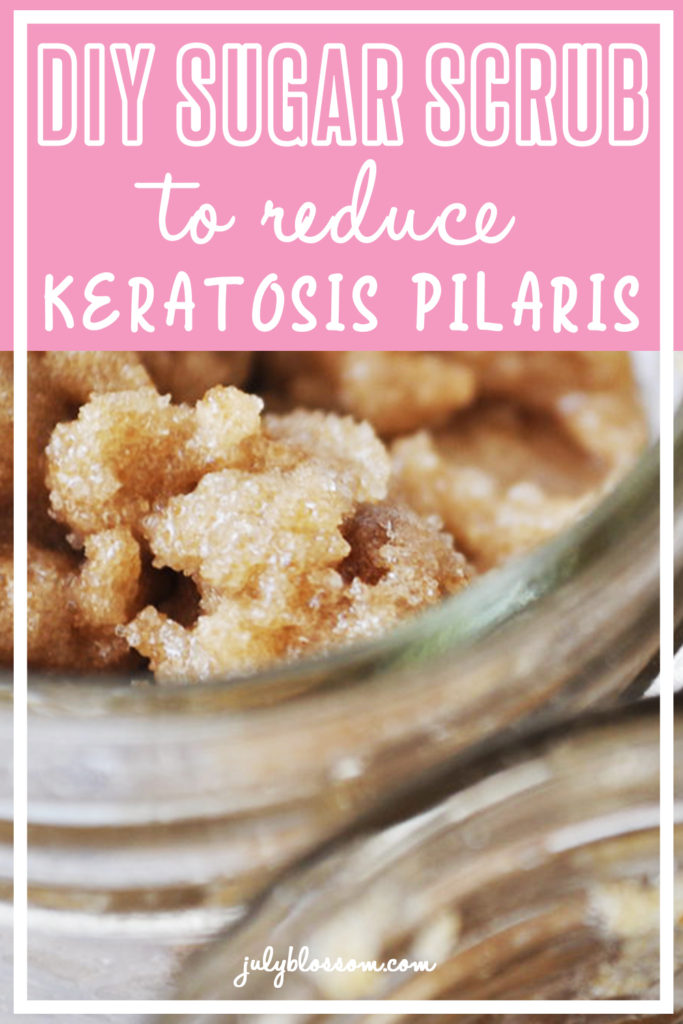 Do you have red or flesh-colored bumps on your arms, thighs or even butt?! This is most likely keratosis pilaris. Thankfully, you can help clear those annoying bumps using this DIY keratosis pilaris sugar scrub. Scroll down if you want to learn how to make it ASAP! 